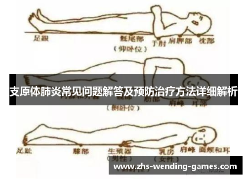 支原体肺炎常见问题解答及预防治疗方法详细解析